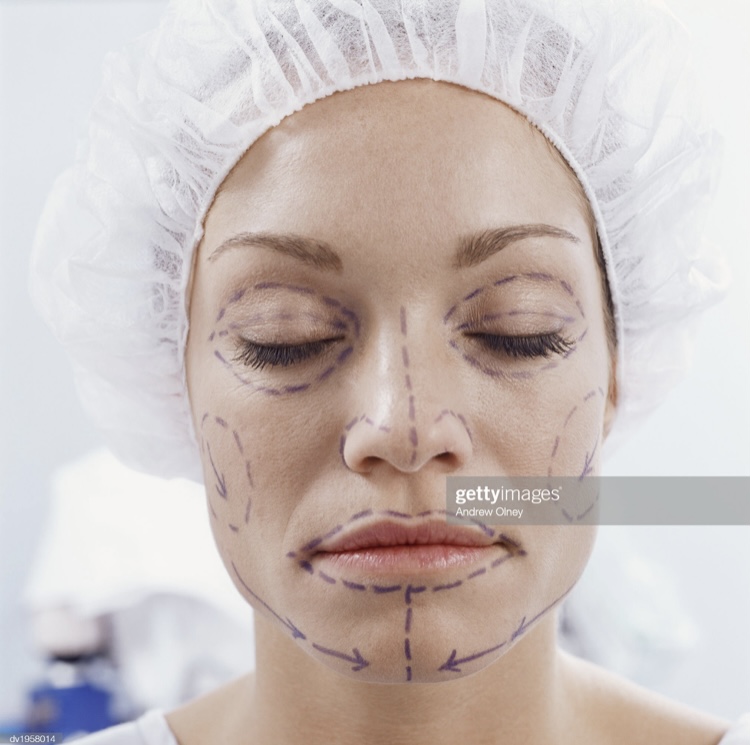 Woman+before+cosmetic+facial+surgery.