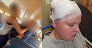 This Image shows a picture of the 12 year old boys head wrapped at the hospital and on the other side of the photo it shows a blurred out image of the 17 year old girl on top of the 12 year old boy.