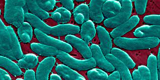 In the picture above is Vibrio vulnificus, which is a bacteria. 